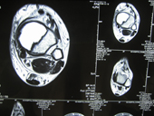 coimbatore-orthopaedic-joint-replacement-maternity-child-welfare-centre-india